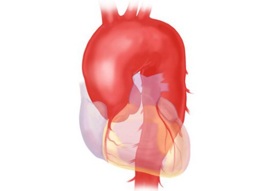 anatomía de la aorta 