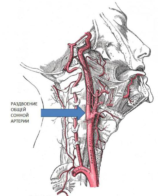 arteria carótida común derecha