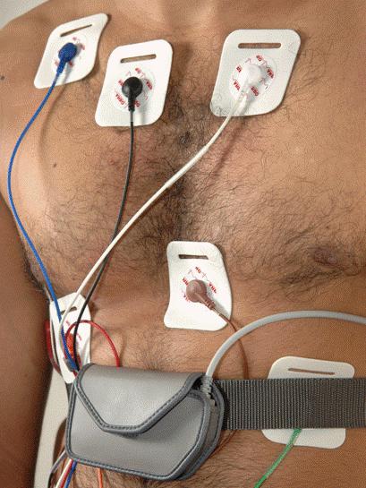 Monitorización diaria del ECG por Holter