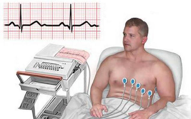 Cómo eliminar un ECG: una descripción del algoritmo, un esquema de aplicación de electrodos y recomendaciones