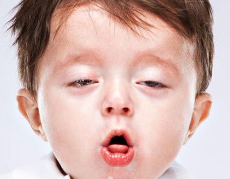 Tos seca en niños sin fiebre: causas y tratamiento